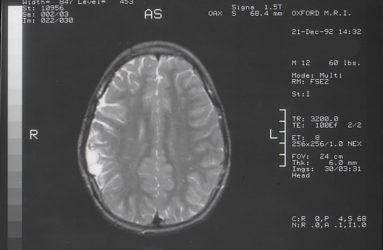 MRI image of cross section of human head