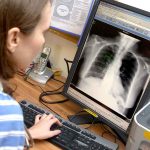 chest x-ray on screen being viewed by staff member