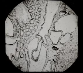 black and white image of tissue sample viewed under microscope