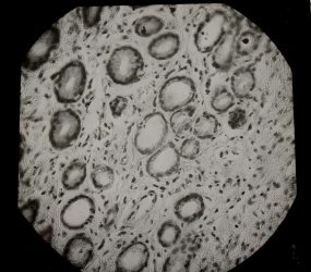 black and white image of tissue sample viewed under microscope