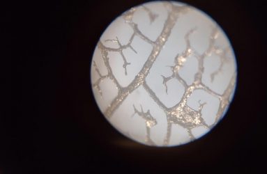 silver looking veins of leaf magnified under microscope